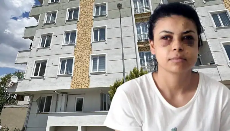Düğünde Maganda Dehşeti: Saçmalarla Gözünden Yaralanan Gelin