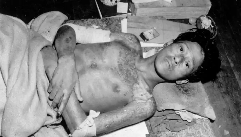 Nagasaki'den 80 Yıl Sonra Geri Dönüş: Nükleer Tehditler Yeniden Gündemde