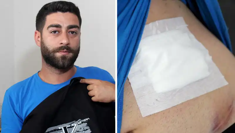 Karnındaki Ağrının Ardındaki Sır: Röntgen Sonuçları İle Şok Edici Gerçek