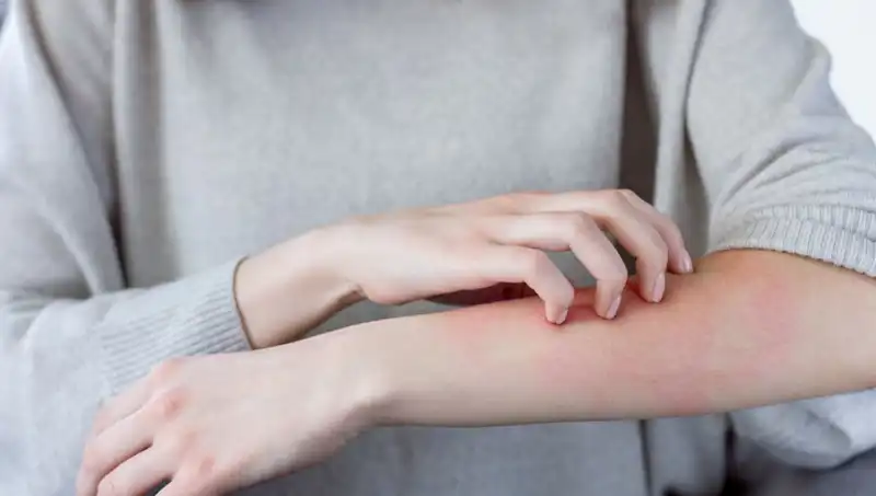 Gözden Kaçırdığınız 2 Cilt Kanseri Belirtisi: Dermatolog Açıkladı!