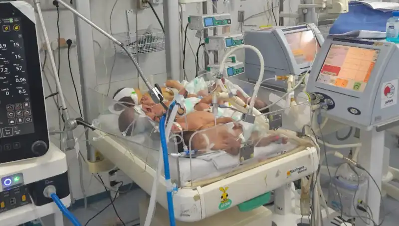 Gazzeli Doktorların Çaresizliği: Kuvözde Birden Fazla Bebek Krizi