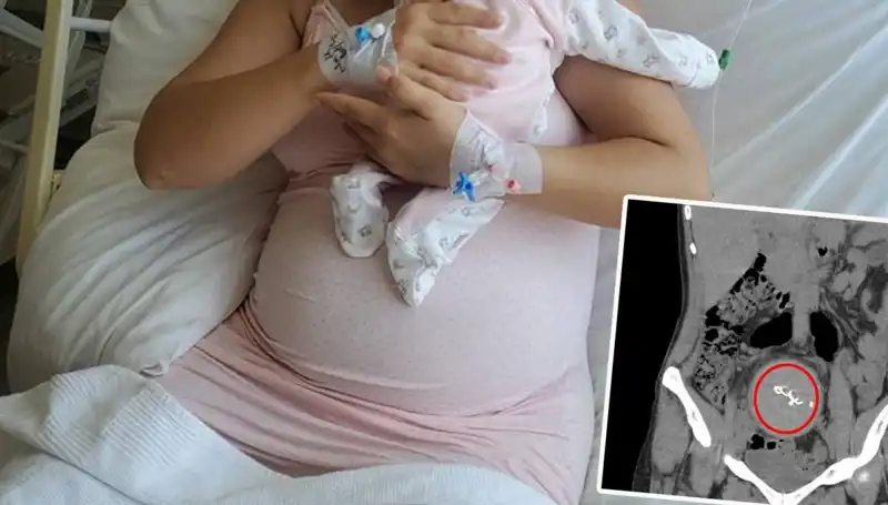 Doğumda Unutulan Bebek İki Yıl Sonra Ortaya Çıktı: Gazlı Bez İhmalinde Şok Gelişme