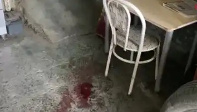 Sandalyeden Düşen Adamın Hayatı Değişti: Ağır Yaralandı